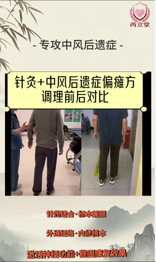 针药调节中风后遗症