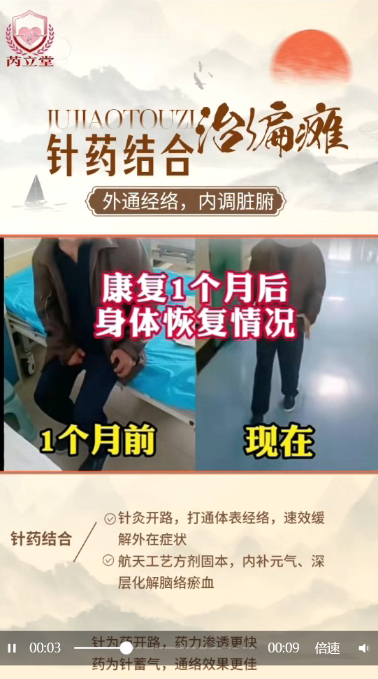 芮立堂特色针药调节中风后遗症