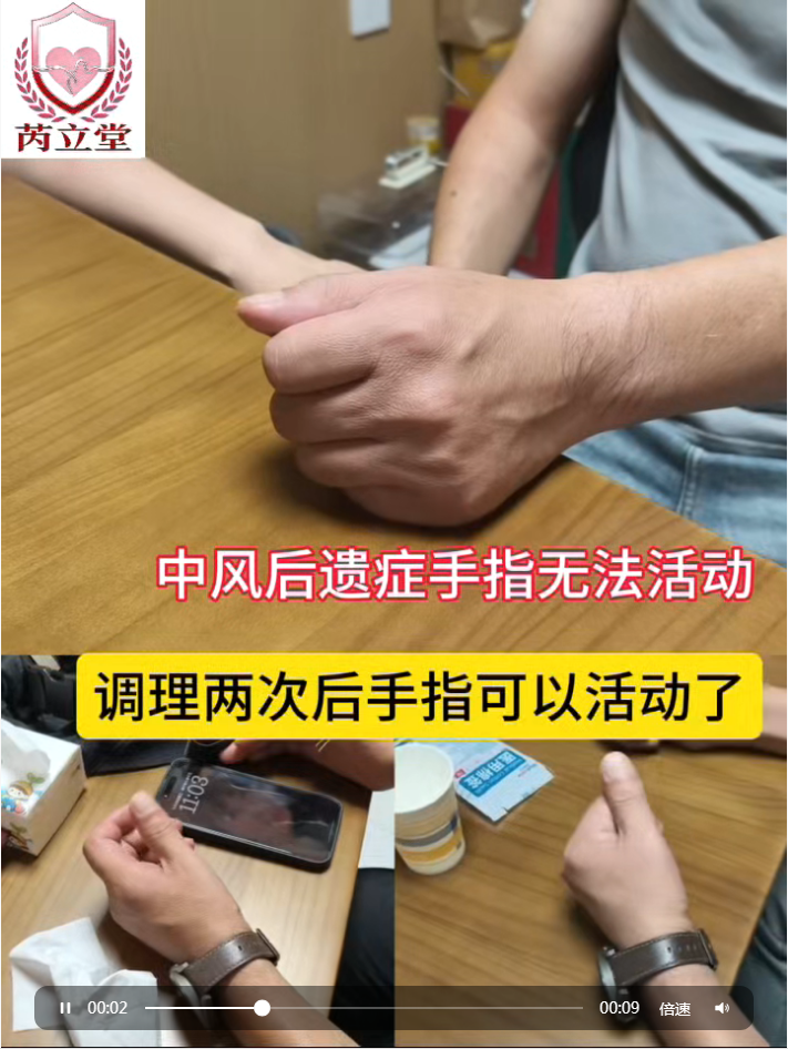 针药调节中风后遗症｜中风后手指僵硬不能活动