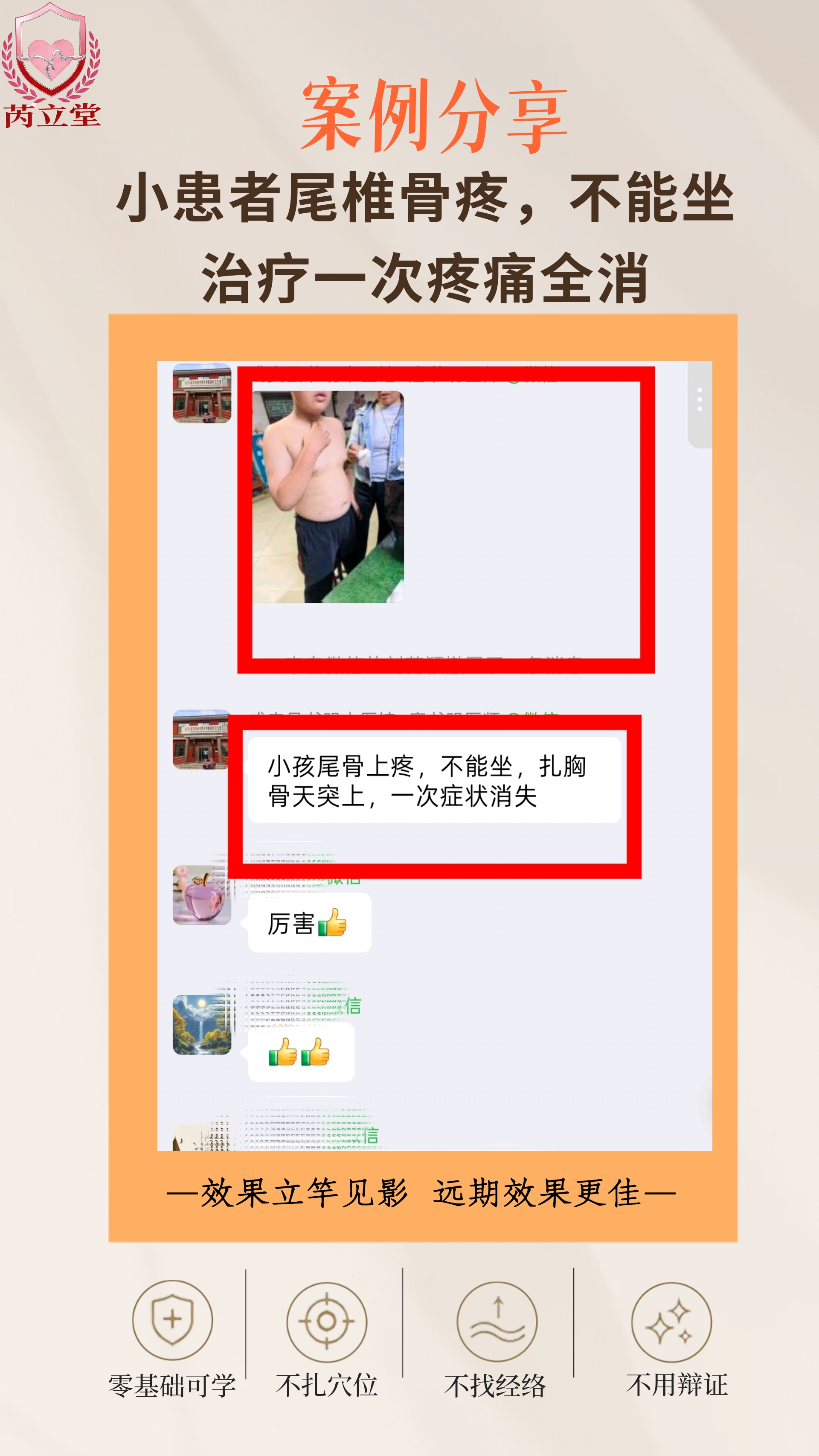 芮立堂特色技法｜尾椎骨疼痛案例